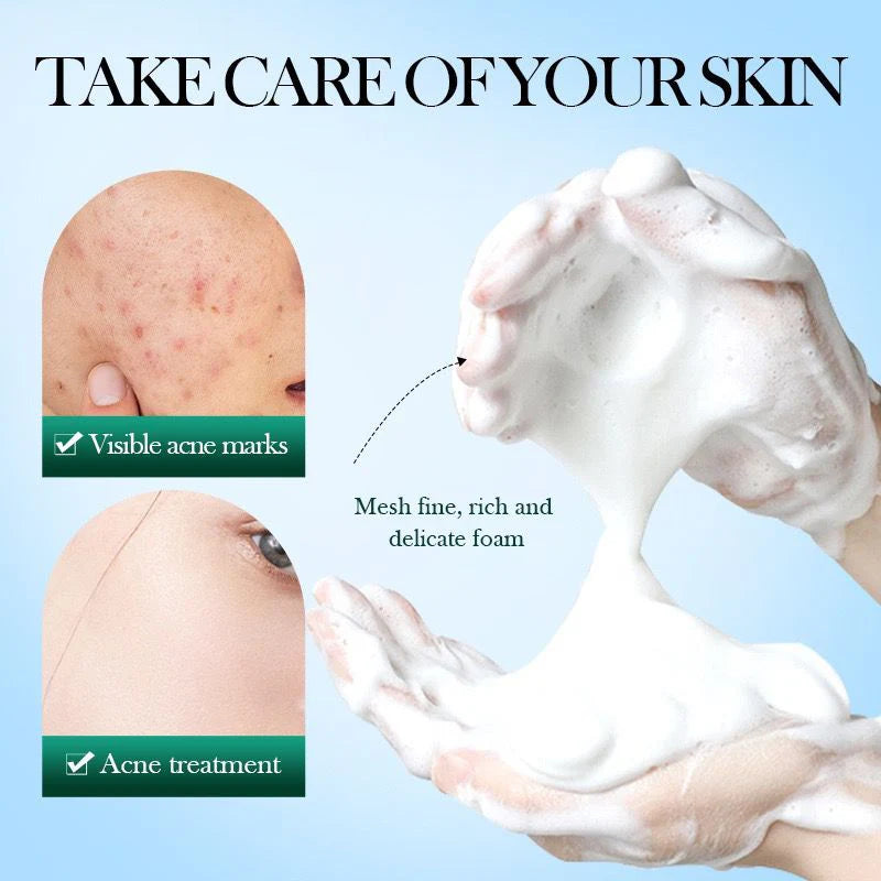 Sadoer Acnes Tea Tree Mousse Facial Cleanser Refreshing & cleaning Skin 150g - SD62685