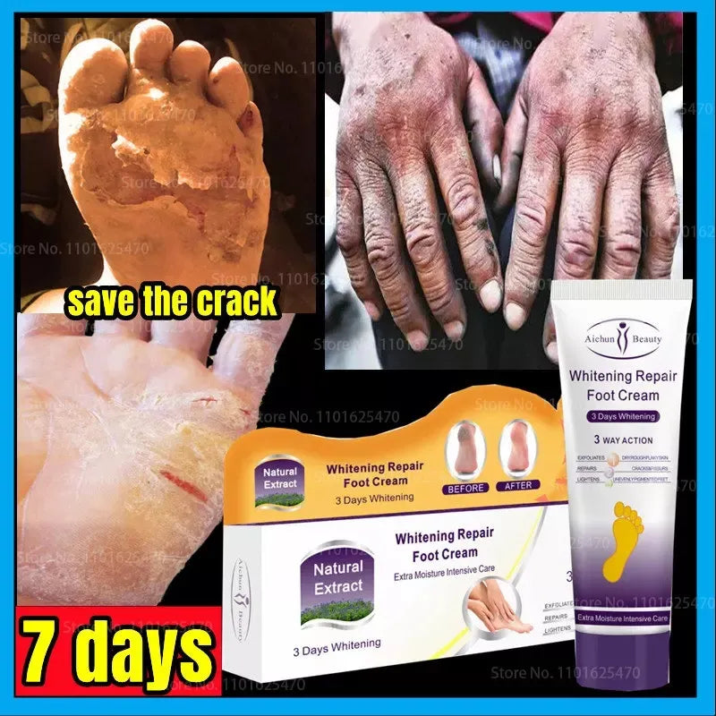 Aichun Beauty Whitening Foot Cream 100 ml