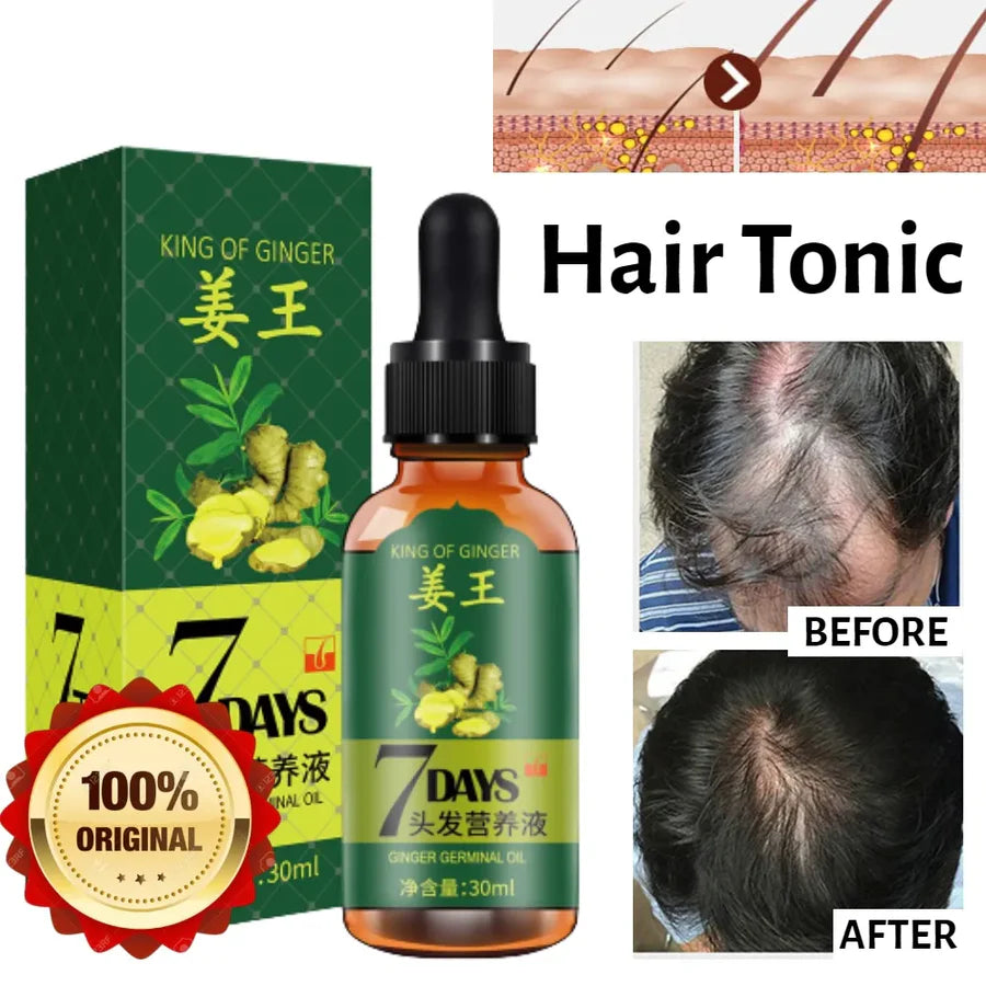 Aichun Beauty 7 Days Ginger Hair Growth Oil Serum For Damaged Hair Treatment- 30ml AC3058