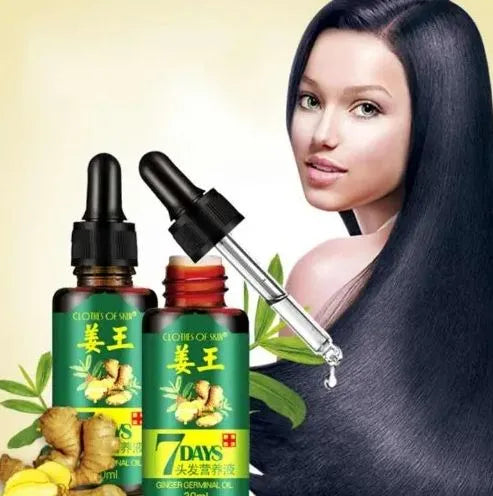 Aichun Beauty 7 Days Ginger Hair Growth Oil Serum For Damaged Hair Treatment- 30ml AC3058
