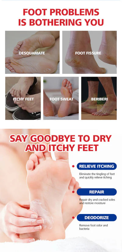Aichun Beauty Foot Cream Balm For Cracked Heel Dead Skin Remover Foot Cream Anti-Crack Deep Moisturizing Foot Cream For Feet Skin Healing Feet Dry Feet Callus Remover 20g AC 2042