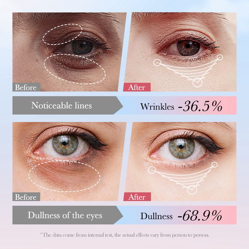 SADOER 4 in 1 Roll-on Moisturizing Eye Cream Anti Dark Circles Eye Bags Firming Moisturizing Eye Serum SD40664