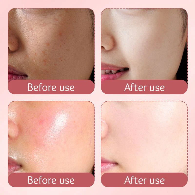 SADOER Milk Preach Vitamin C Face Cream – Whitening & Brightening Moisturizer