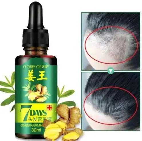 Aichun Beauty 7 Days Ginger Hair Growth Oil Serum For Damaged Hair Treatment- 30ml AC3058