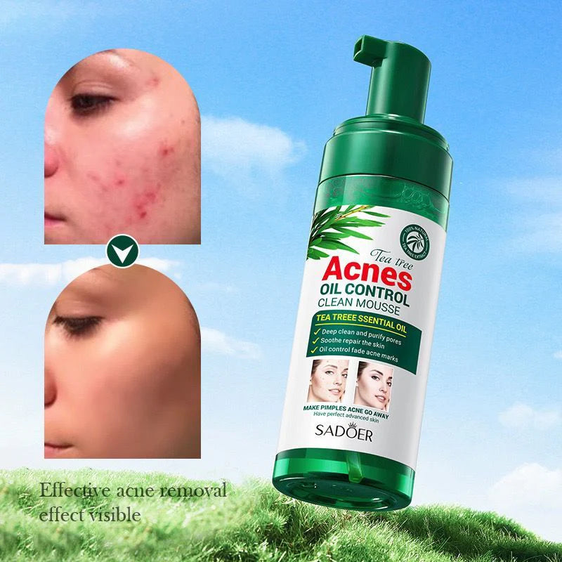 Sadoer Acnes Tea Tree Mousse Facial Cleanser Refreshing & cleaning Skin 150g - SD62685