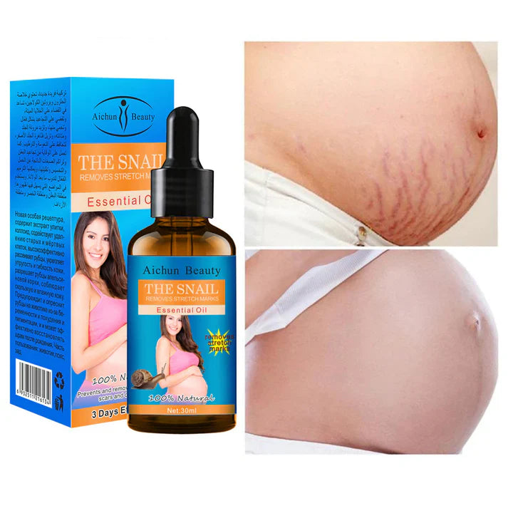 Aichun Beauty The Snail Remove Stretch Marks Essential Oil